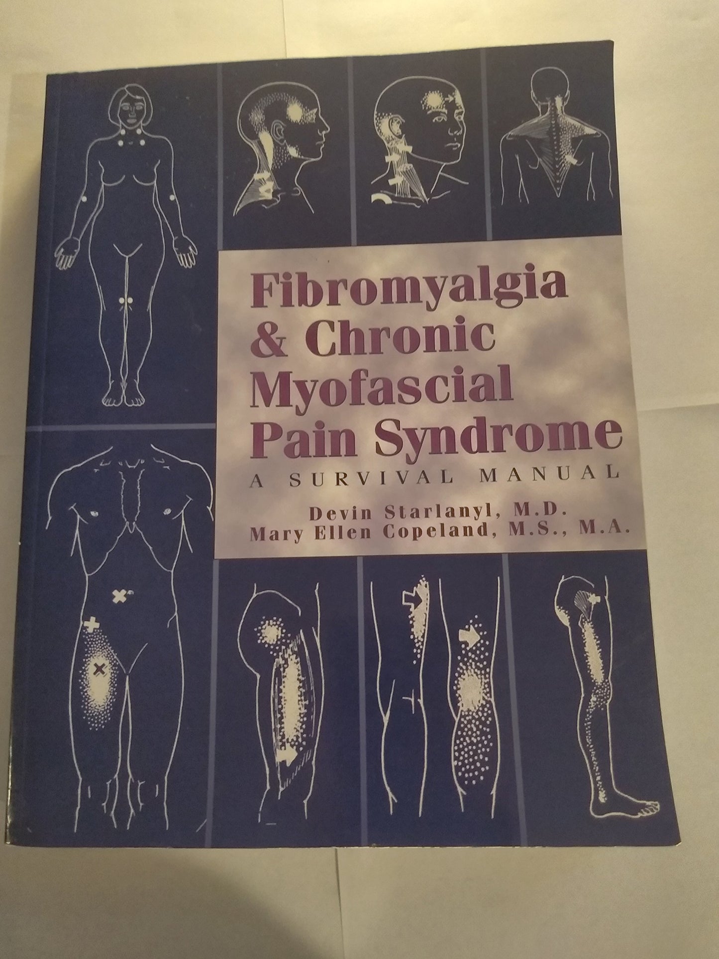 Fibromyalgia & Chronic Myofascial Pain Syndrome: A Survival Manual book cover